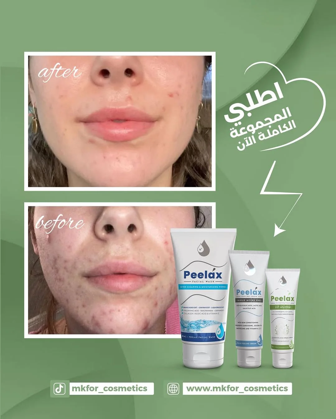 Before and after photographs of a Peelax customer, shown with the facial wash, peeling cream and moisturiser
